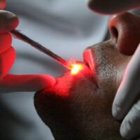 Benefícios da Laserterapia na Odontologia