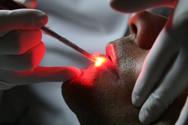 Leia mais sobre o artigo Benefícios da Laserterapia na Odontologia
